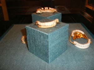 dental crowns history Indianapolis