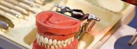 Pre-prosthetic surgery Indianapolis