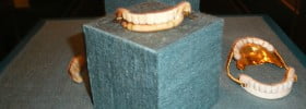 history of dental crowns Indianapolis
