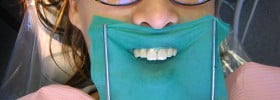 cosmetic dentistry Indianapolis